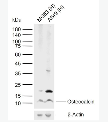 Anti-Osteocalcin antibody -骨钙蛋白/骨钙素抗体,Osteocalcin