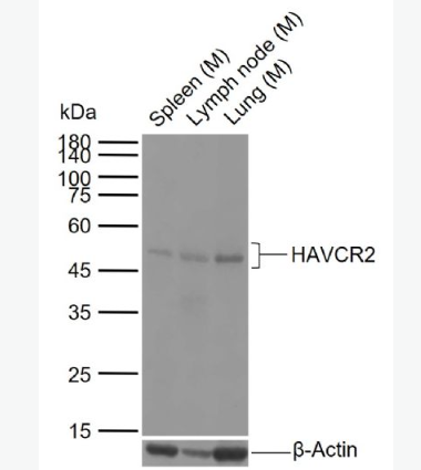 Anti-HAVCR2/TIM-3 antibody -T淋巴细胞膜蛋白3(CD366)抗体,HAVCR2/TIM-3