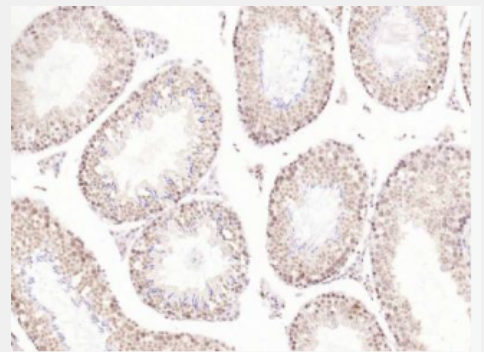 Anti-FEstrogen receptor beta antibody -雌激素受体β抗体,Estrogen receptor beta