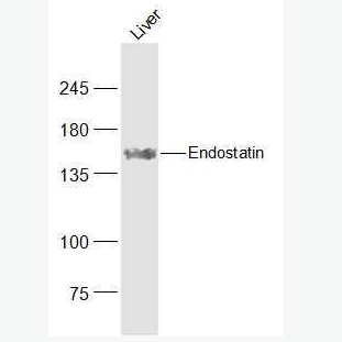 Anti-Endostatin antibody -内皮抑素/内皮他丁抗体,Endostatin