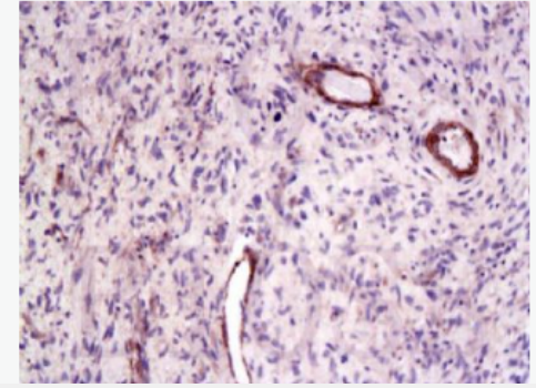 Anti-CTGF antibody -結(jié)締組織生長因子抗體,CTGF