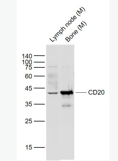 Anti-CD20 antibody -CD20抗体,CD20