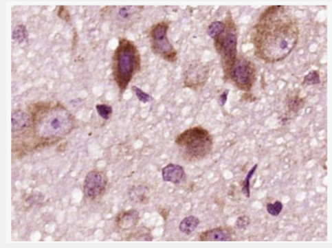 Anti-DRD2 antibody -多巴胺受体D2抗体,DRD2