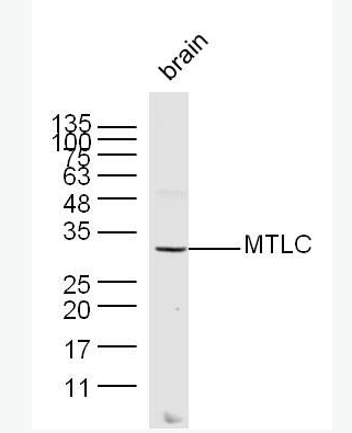 Anti-MTLC antibody -致癌基因抗体,MTLC