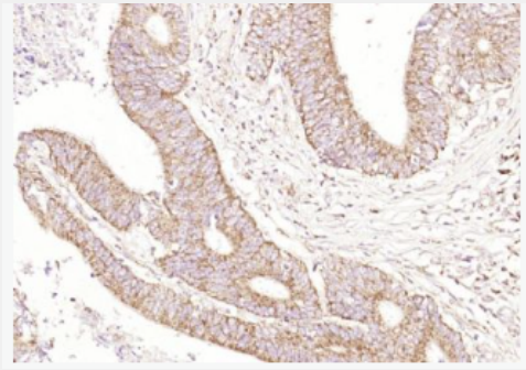 Anti-CEAcam8 antibody -癌胚抗原相关细胞粘附分子8抗体,CEAcam8