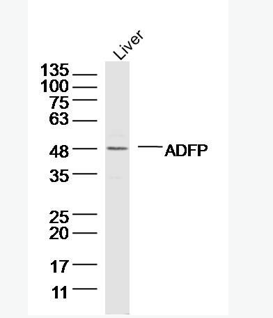 Anti-Perilipin-2 antibody -脂肪分化相关蛋白抗体,Perilipin-2