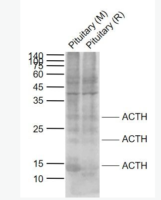 Anti-ACTH (7-23) antibody -促肾上腺皮质激素ACTH (7-23)抗体,ACTH (7-23)