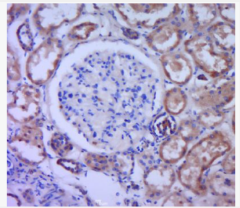 Anti-GNRH/LHRH antibody-黄体激素释放激素类似物抗体,GNRH/LHRH