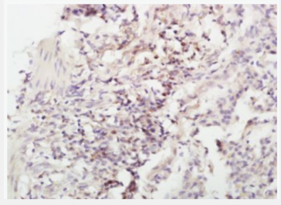 Anti-IL-4 antibody-白介素4抗体,IL-4