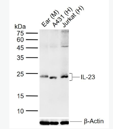 Anti-IL-23 antibody-白介素-23抗体,IL-23