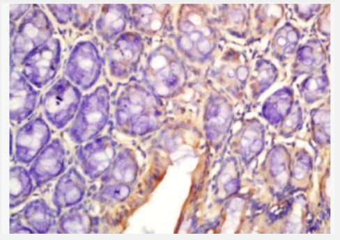 Anti-IL-2 antibody-白介素2抗体,IL-2