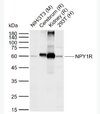 Anti-NPY1R antibody-神经肽Y1受体抗体,NPY1R
