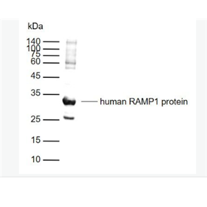 Anti-RAAnti-RAMP1 antibody -受体活性修饰蛋白1抗体MP1 antibody -受体活性修饰蛋白1抗体