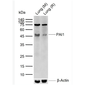Anti-PAI1 antibody -纤溶酶原激活物抑制因子抗体,PAI1