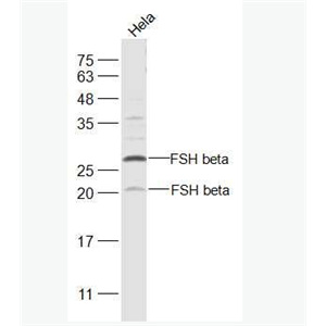 Anti-FSH beta antibody -促卵泡刺激素抗体,FSH beta