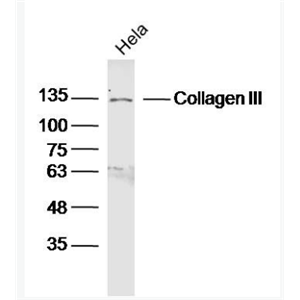 Anti-Collagen III antibody -Ⅲ型胶原蛋白/胶原蛋白3/3型胶原蛋白抗体