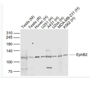 Anti-EphB2 antibody -酪氨酸蛋白激酶受体B2抗体