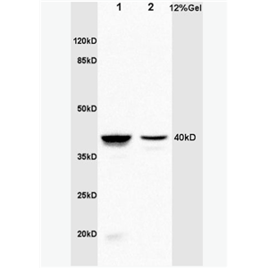 Anti-Annexin A1 antibody -膜粘连蛋白A1抗体,Annexin A1