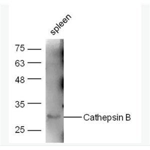 Anti-Cathepsin B antibody -组织蛋白酶B抗体