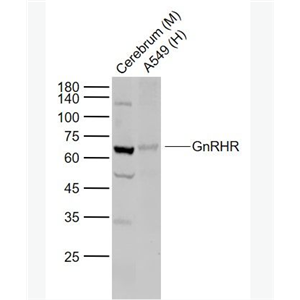 Anti-GnRHR antibody -促性腺激素释放激素受体抗体