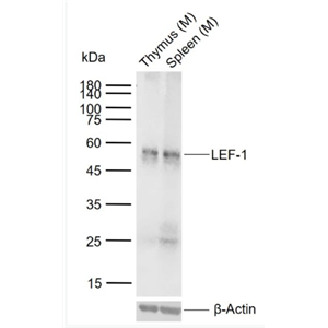 Anti-LEF-1 antibody -淋巴增强因子-1抗体,LEF-1