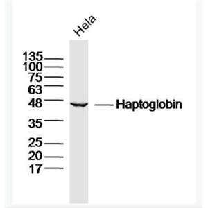 Anti-Haptoglobin antibody -结合珠蛋白/触珠蛋白抗体,Haptoglobin