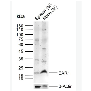 Anti-EAR1 antibody -嗜酸性粒细胞阳离子蛋白抗体,EAR1