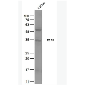 Anti-E2F5 antibody -转录因子E2F-5抗体
