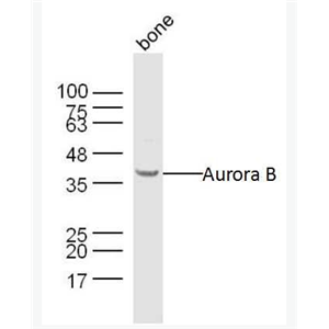 Anti-Aurora B antibody -有丝分裂激酶B抗体