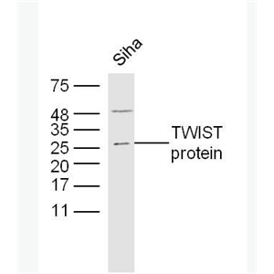 Anti-TWIST antibody -TWIST蛋白抗体,TWIST