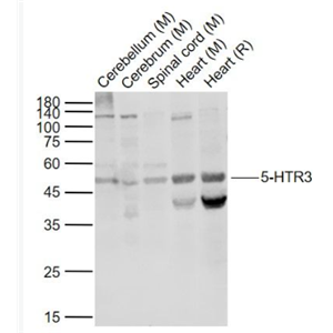 Anti-5-HTR3 antibody -5-羟色胺受体3抗体,5-HTR3