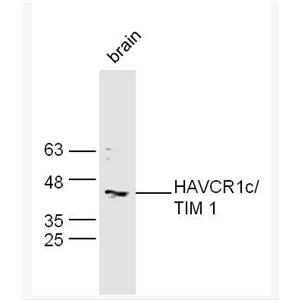 Anti-HAVCR1 antibody -肾损伤分子1/甲型肝炎病毒细胞受体1抗体