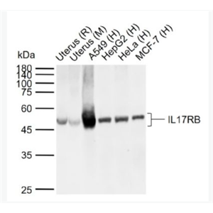 Anti-IL17RB antibody -白介素-17B受体抗体