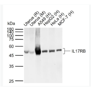 Anti-IL17RB antibody -白介素-17B受体抗体,IL17RB