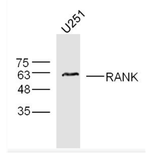 Anti-RANK antibody -核转录因子NF-κB受体抗体(核因子kB受体活化因子)