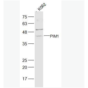 Anti-PIM1 antibody -丝氨酸/苏氨酸激酶蛋白Pim1抗体
