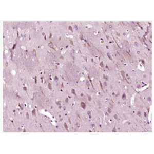 Anti-LC3B antibody -自噬微管相关蛋白轻链3抗体