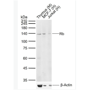 Anti-Rb antibody -成视网膜细胞瘤基因抗体