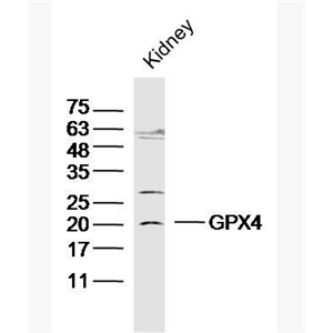 Anti-GPX4 antibody -中文名称谷胱甘肽过氧化酶4抗体