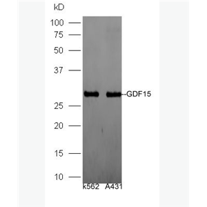 Anti-GDF15 antibody -生长分化因子15/巨嗜细胞抑制因子1抗体