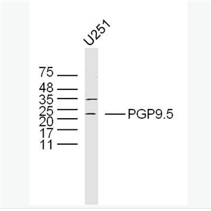 Anti-PGP9.5 antibody -神经细胞胞浆蛋白9.5/蛋白基因产物9.5抗体