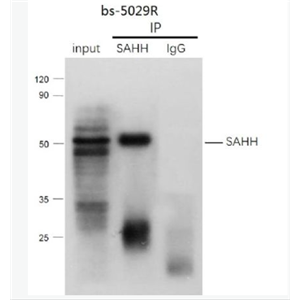 Anti-SAHH antibody -S腺苷L-同型半胱氨酸水解酶抗体,SAHH