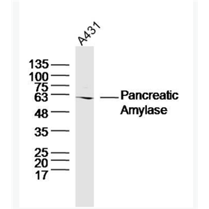 Anti-Pancreatic Amylase antibody -胰淀粉酶抗体,Pancreatic Amylase
