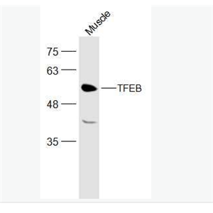 Anti-TFEB antibody -T淋巴细胞转录调节因子TFEB抗体