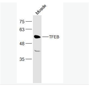 Anti-TFEB antibody -T淋巴細(xì)胞轉(zhuǎn)錄調(diào)節(jié)因子TFEB抗體