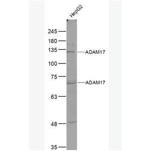 Anti-ADAM17 antibody -肿瘤坏死因子α转换酶抗体,ADAM17