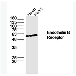 Anti-Endothelin B Receptorantibody -内皮素B受体抗体