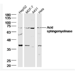 Anti-Acid sphingomyelinase antibody -酸性神经鞘磷脂酶抗体