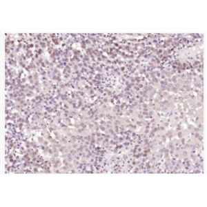 Anti-TRIB3 antibody -神经细胞死亡诱导蛋白激酶抗体