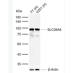 Anti-SLC26A4 antibody -钠碘单独转运蛋白SLC26A4抗体